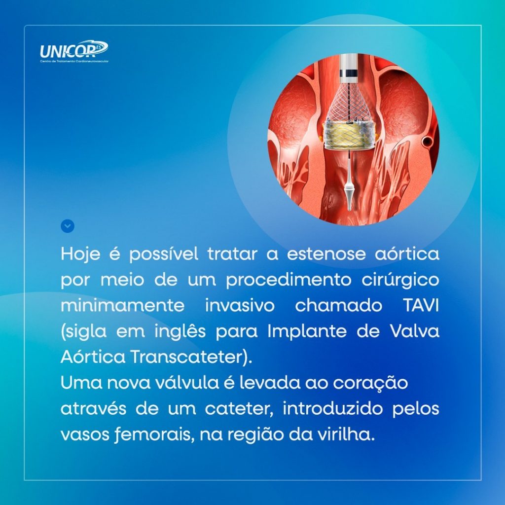 tavi (6)